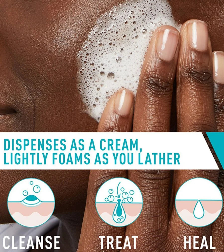 CeraVe Acne Foaming Cream Cleanser – 150ml